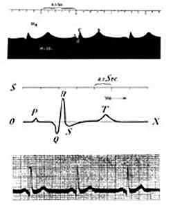 Primer electrocardiógrafo
