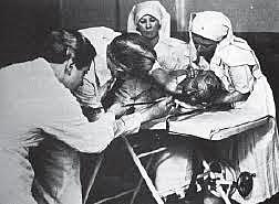 Gastroscopio articulado.