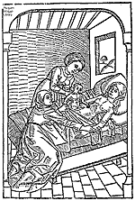 Jacob Nufer, castrador de cerdos, realizó una cesárea en su esposa, con buen éxito tanto para la madre como para el niño.