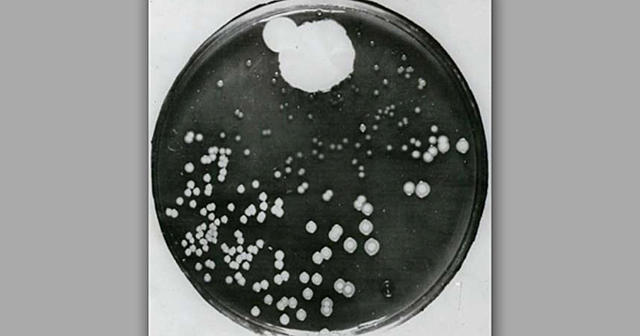 Discovery of Penicillin