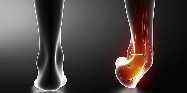 Tuve mi primer esguince