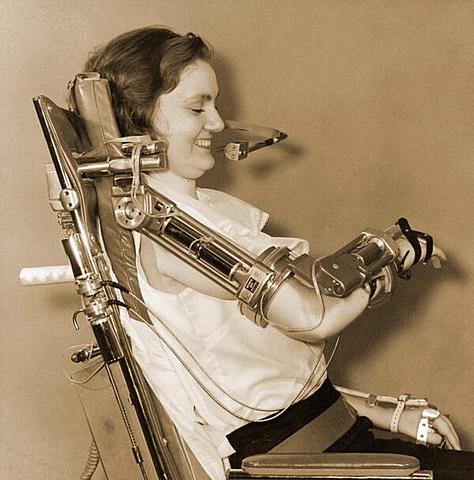 1963 - Artificial Arms