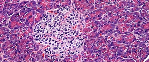 Soonja: Road to pathology