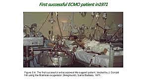 First Life-Support machine