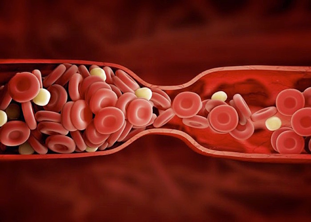 Heparina como anticoagulante