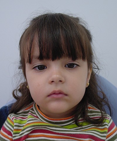 irrupção dentes decíduos