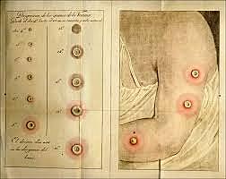 EDWARD JENNER INTRODUJO LA VACUNA ANTIVARIOLICA