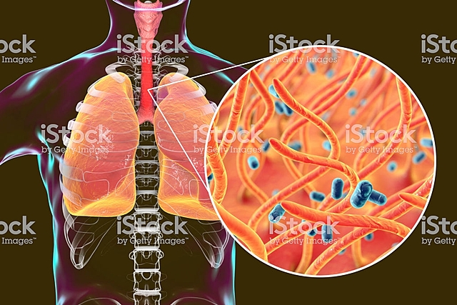 Aíslación de Bordetella pertussis.