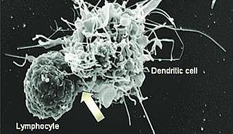 Células dentriticas