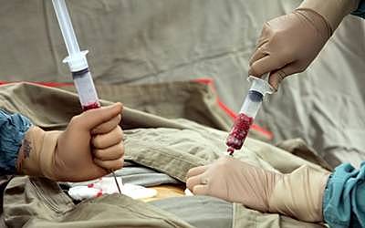 Transplante de Médula osea