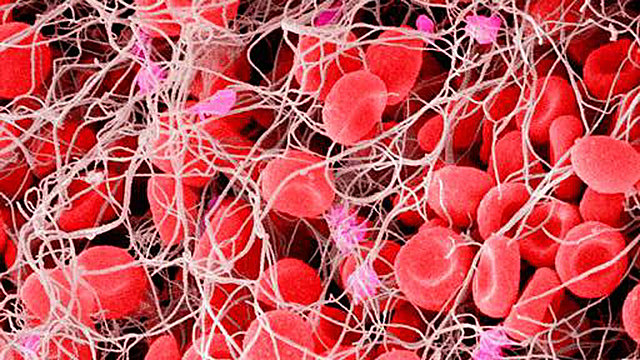 Heparina utilizada como anticoagulante