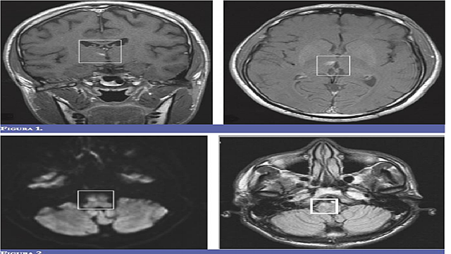 Exámenes paraclinicos
