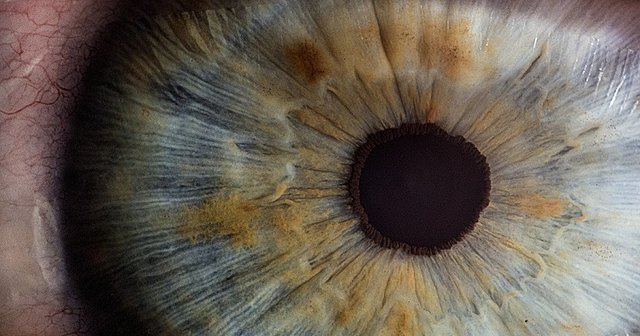 Kleist y Poppelreuter - apraxia óptica