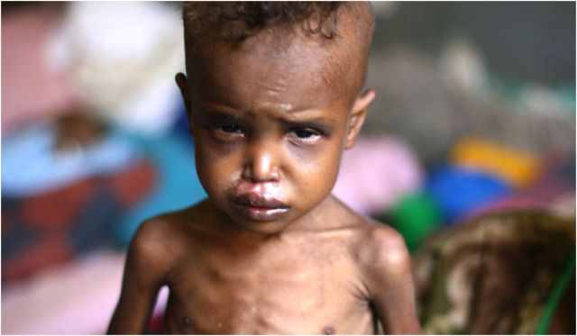 Bad Health Conditions due to Illetercy