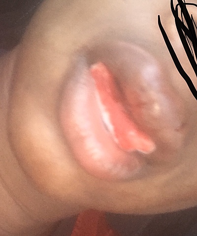 Getting Injured at Semi Finals