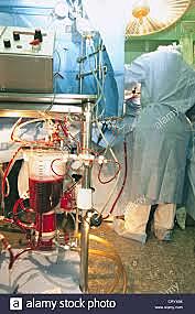 Circulación extracorpórea