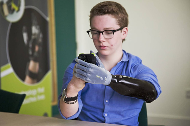 Biotecnología: manos biónicas