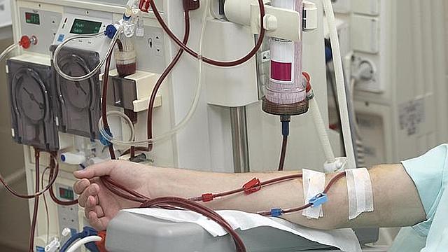 Desarrollo de la diálisis para la insuficiencia renal