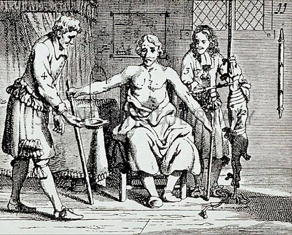 Primera transfusión de sangre