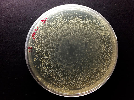 Cultivo selectivo de bacterias