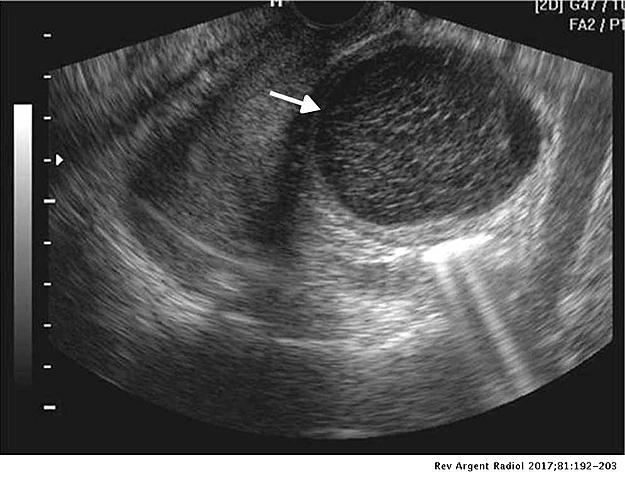 ORIGEN DE LA ECOGRAFÍA.