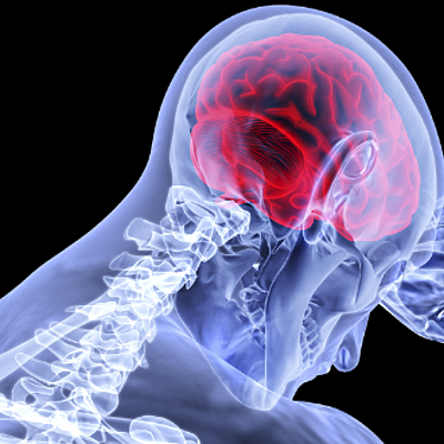 Timeline: CASO CLÍNICO ACV