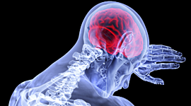 Timeline: CASO CLÍNICO ACV