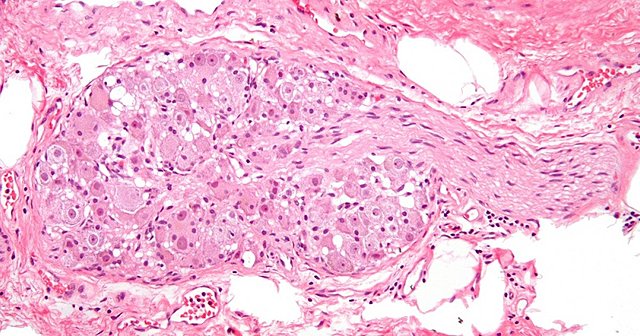 Ganglios Cerebroespinales