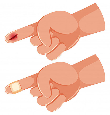 Juan se cortó ayudando a su papá