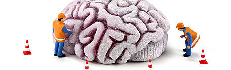 ALTERACIONES COGNOSCITIVAS