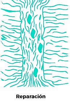 II. FASE PROLIFERATIVA TENDINOSA