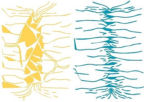 III. REMODELACIÓN TENDINOSA