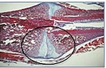 IV. REEMPLAZO POR HUESO - REPARACIÓN TEJIDO ÓSEO