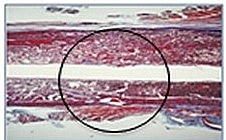 V. REMODELACIÓN - REPARACIÓN TEJIDO ÓSEO