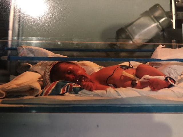 First to come home from the hospital