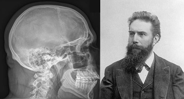 Primera radiografía