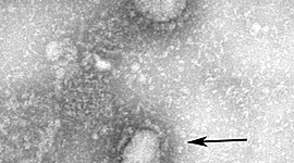 Timeline: 2020中国新型冠状病毒肺炎疫情大事记