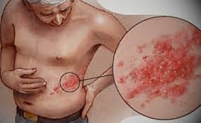 "La Culebrilla" José Patrón Correa.