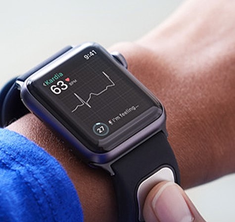 Diagnóstico de fibrilación auricular mediante reloj inteligente