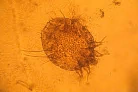 primera enfermedad cuyo estudio etológico se ciñó al método científico