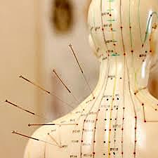 ACUPUNTURA