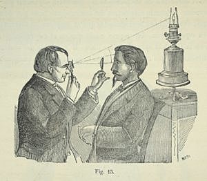 Invento de Helmholtz.