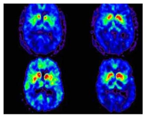 he decided to go public with his desise