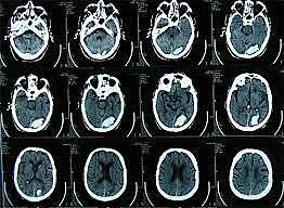 PERIODO CONTEMPORÁNEO