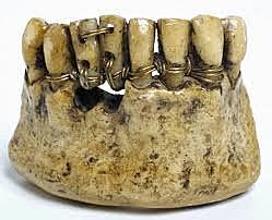 Dentadura de porcelana postiza