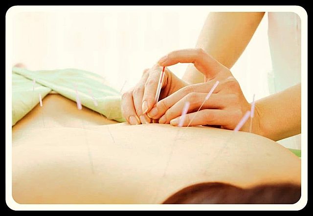 ACUPUNTURA CHINA, MEDICINA ALTERNATIVA