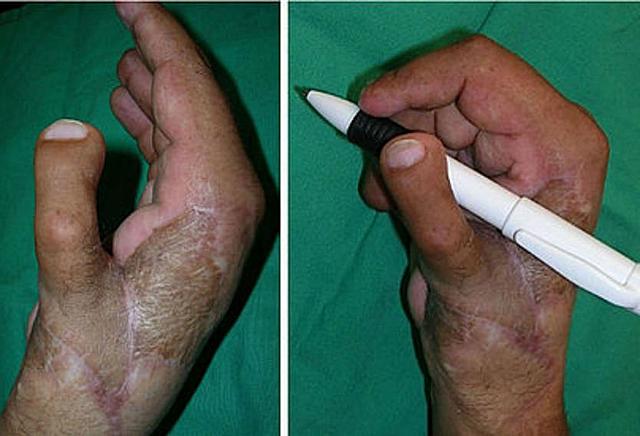 CIRUGÍA En la segunda mitad del siglo XX