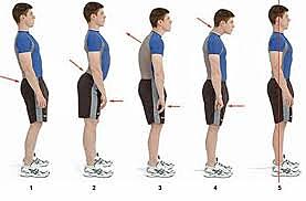 Técnica de Alexander