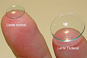 Lentes de Contacto Esclerales