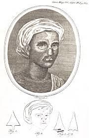 El "boom" de los colgajos nasales.